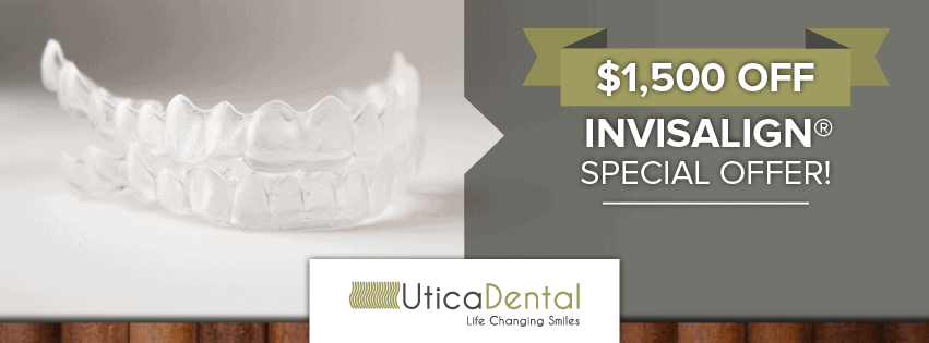 Invisalign Special Offer $1500 Off!
