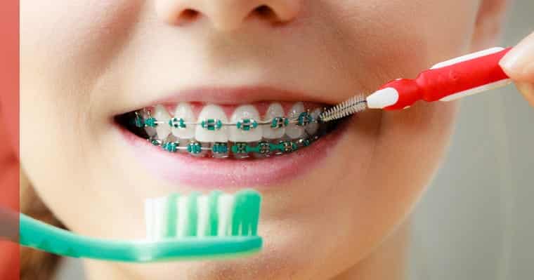 Have you changed your hygiene routine with braces? Patient with braces smiling with an ortho brush and toothbrush next to mouth