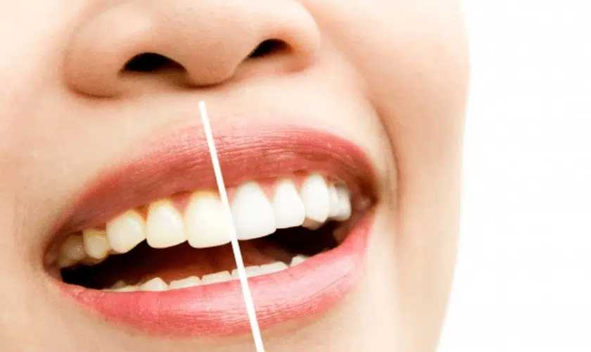 cosmetic dentist tulsa ok