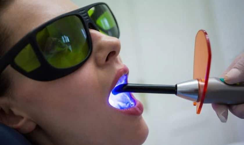 Everything You Need To Know About Laser Periodontal Therapy (LANAP)