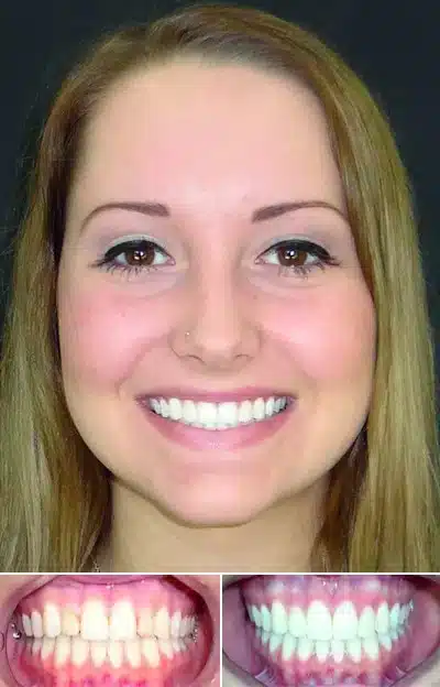 patient's before after